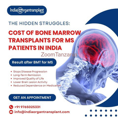Bone Marrow Transplant for Multiple Sclerosis in india