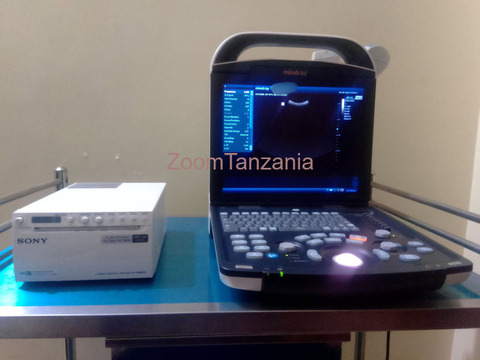 Portable Mindray Ultrasound, Transducers and Printer - 2/6